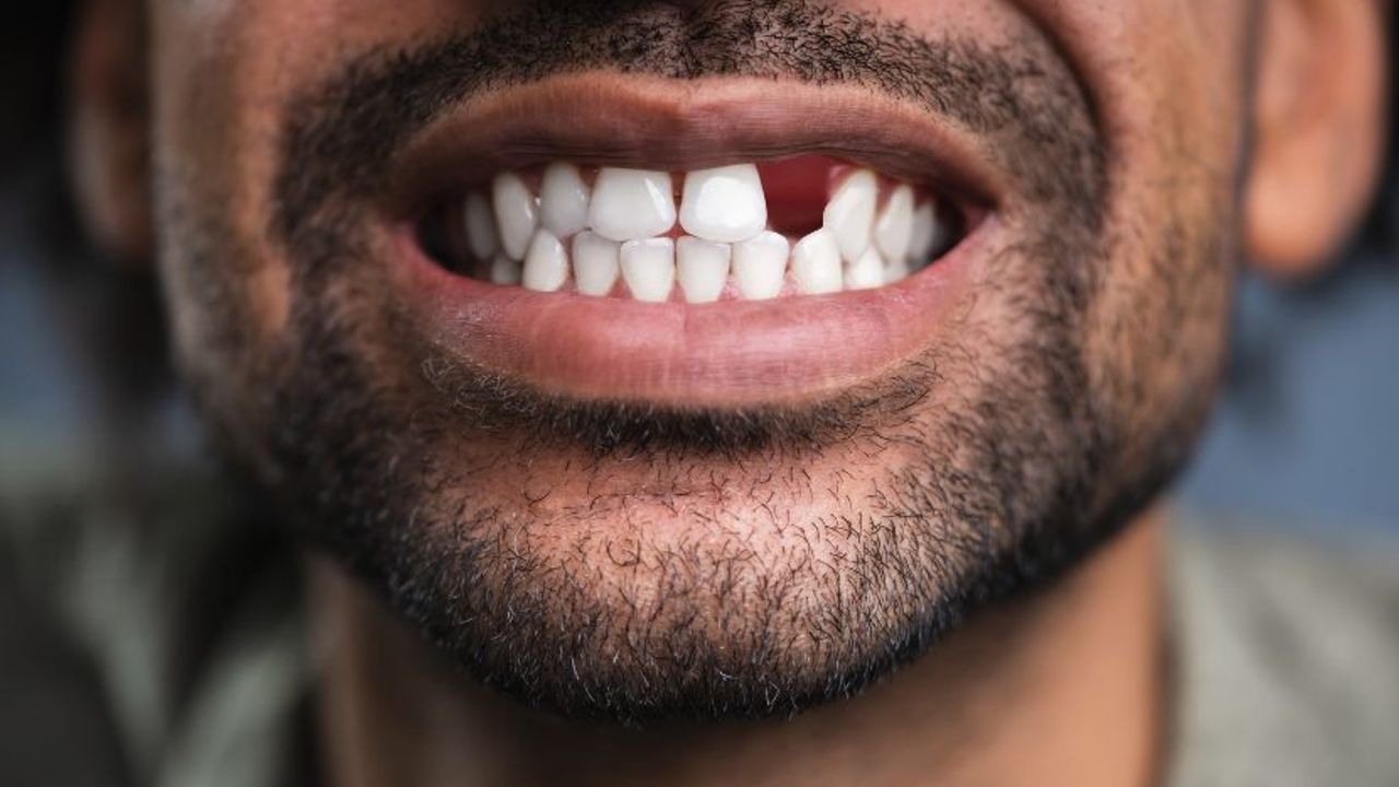 Dişler hakkında eğlenceli gerçekler