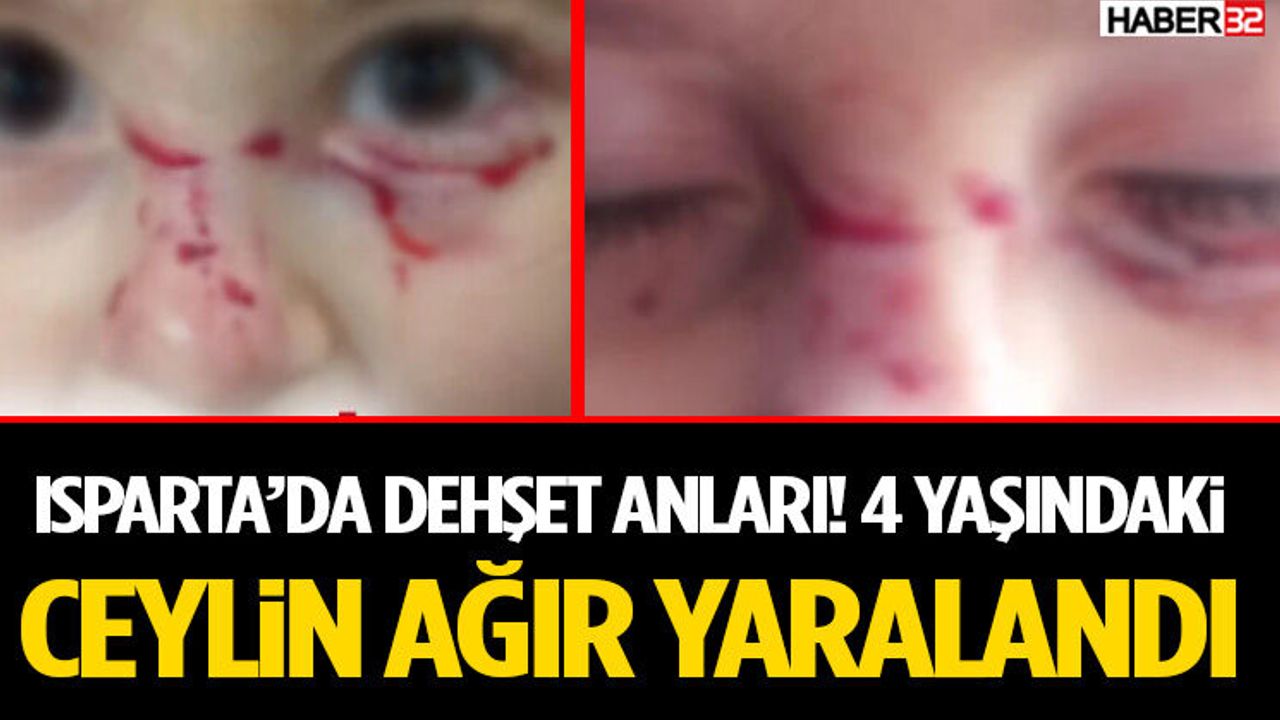 Isparta’da Korkunç Anlar! 4 Yaşındaki Ceylin Ağır 