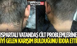 Isparta'da Bir Vatandaş, Cilt Problemlerine Çare Bulduğunu Açıkladı