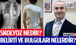 Skolyoz Nedir? Belirti ve Bulguları Nelerdir?