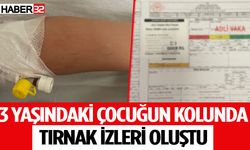 Çocuğun kolunda tırnak izleri oluştu, aile şikayetçi oldu