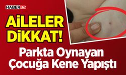 Aileler Dikkat! Parkta Oynayan Çocuğa Kene Yapıştı