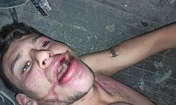 Hamam böceği yedirilen gencin dosyasında karar