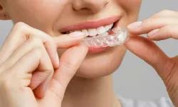 Sosyal Hayatınızdan Ödün Vermeden Mükemmel Gülüşe Ulaşın