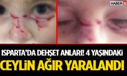 Isparta’da Korkunç Anlar! 4 Yaşındaki Ceylin Ağır Yaralandı