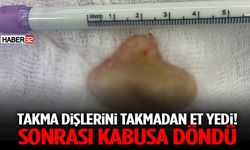 Takma Dişlerini Takmadan Et Yedi! Sonrası Kabusa Döndü