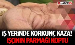 İş Yerinde Korkunç Kaza! İşçinin Parmağı Koptu