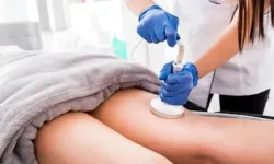 Ultrason Destekli Yağ Alma Tekniği Vücut Hatlarını Nasıl Belirginleştirir?