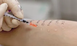 Check Up ve Alerji Testi Arasındaki Fark Nedir?