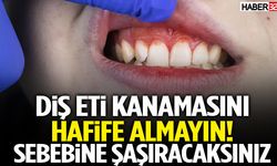 Dişlerinizdeki Bu Belirtiyi Hafife Almayın! Sebebine Şaşıracaksınız