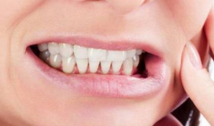 Çocuklarda diş sıkma neyin habercisi?