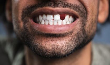 Dişler hakkında eğlenceli gerçekler