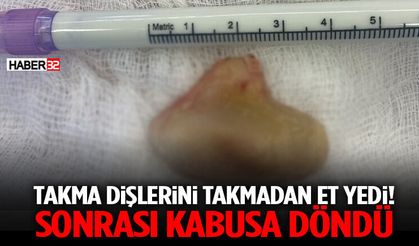 Takma Dişlerini Takmadan Et Yedi! Sonrası Kabusa Döndü