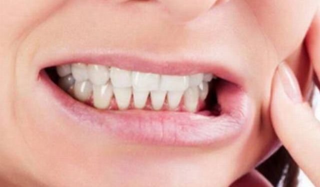 Çocuklarda diş sıkma neyin habercisi?