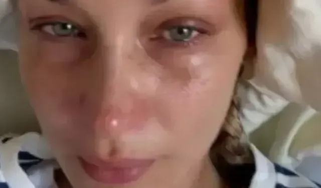 Bella Hadid nasıl Lyme hastası oldu? Bella Hadid'in hastalığı nedir?