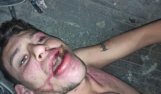 Hamam böceği yedirilen gencin dosyasında karar