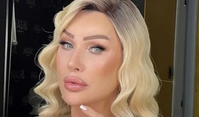 Seda Sayan yüzüne ne yaptırdı, kaç tane estetik operasyonu geçirdi?