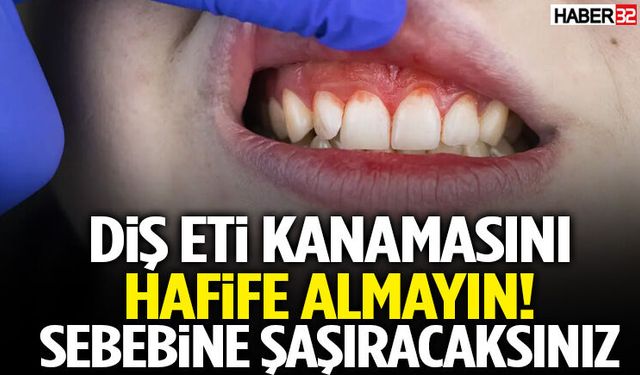 Dişlerinizdeki Bu Belirtiyi Hafife Almayın! Sebebine Şaşıracaksınız