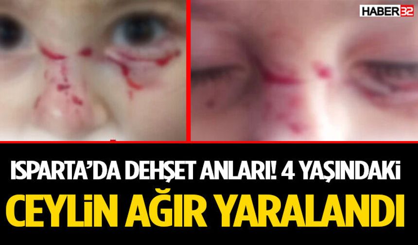 Isparta’da Korkunç Anlar! 4 Yaşındaki Ceylin Ağır Yaralandı