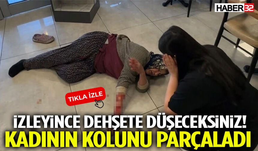 İzlemeye Yürek Dayanmaz! Kadının Kolunu Parçaladı