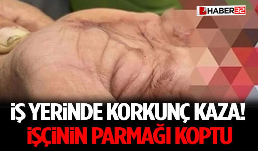 İş Yerinde Korkunç Kaza! İşçinin Parmağı Koptu