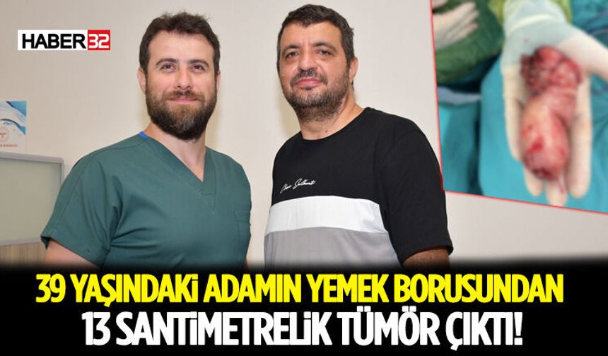 39 Yaşındaki Adamın Yemek Borusundan 13 Santimetrelik Tümör Çıktı!
