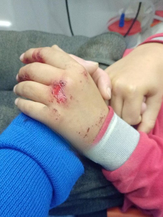 Isparta’da Akran Zorbalığı Dehşeti 8 Yaşındaki Çocuk Hastanelik Olduanne Esra Davraz “Ben Bir (1) Cleanup