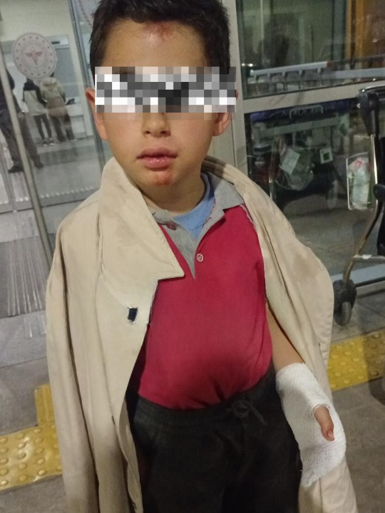 Isparta’da Akran Zorbalığı Dehşeti 8 Yaşındaki Çocuk Hastanelik Olduanne Esra Davraz “Ben Bir (2) Cleanup