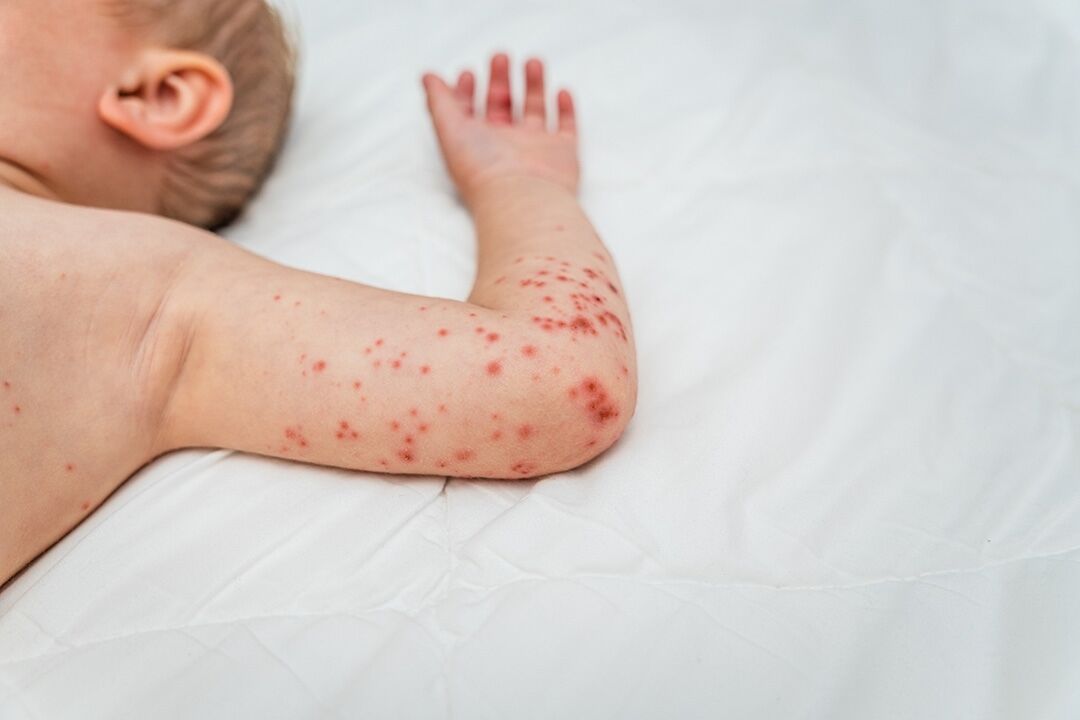 Mpgaziantep Kizamik Asisi,510 Bi