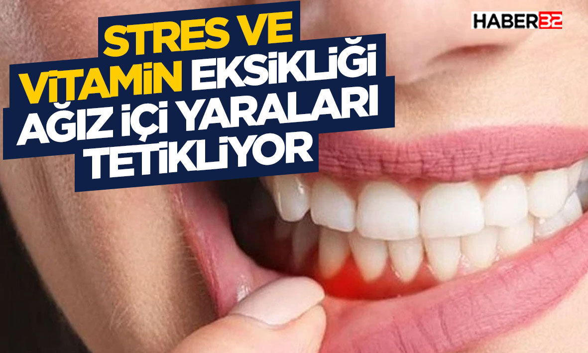 Stres ve vitamin eksikliği ağız içi yaraları tetikliyor